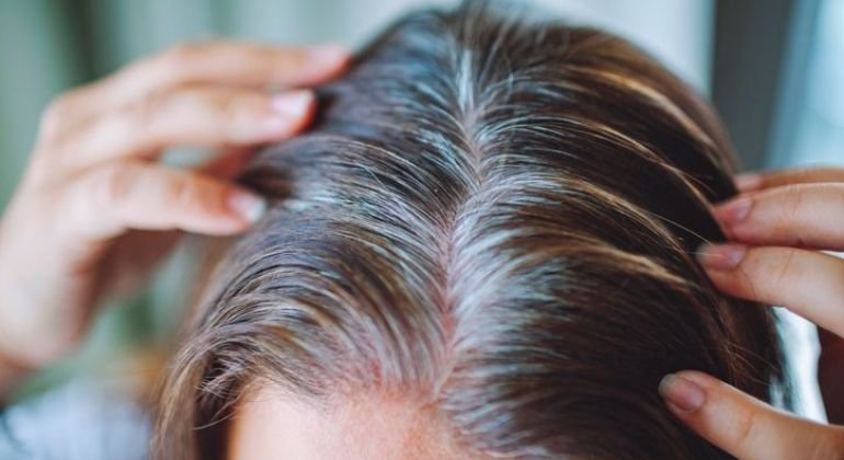Why Quality Matters for Thinning Hair On Top Of Head Solutions