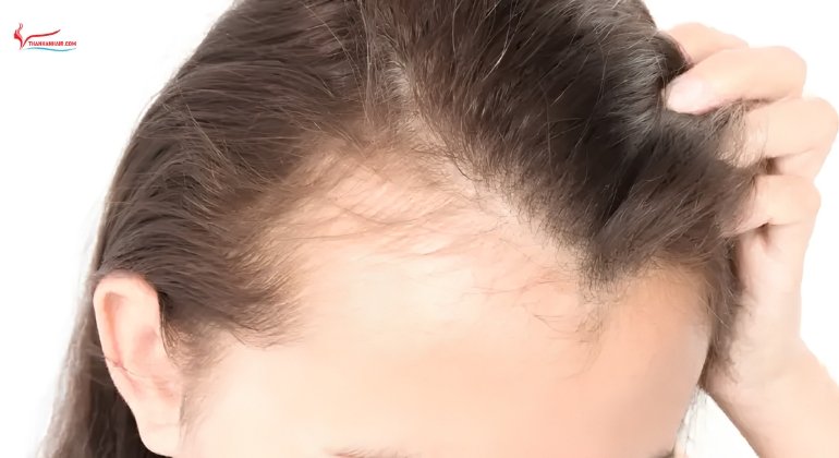 The Real Risk of Daily Wear Traction Alopecia