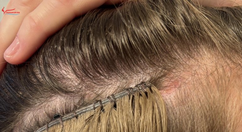 Why hair extensions cannot heal themselves
